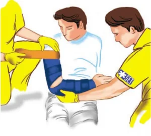 دفترچه راهنمای آتل بلو اسپلینت