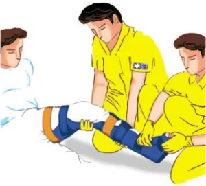 دفترچه آتل بلو اسپلینت