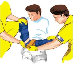 دفترچه راهنمای آتل بلو اسپلینت