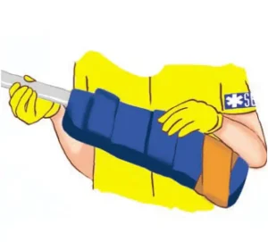 راهنمای آتل بلو اسپلینت